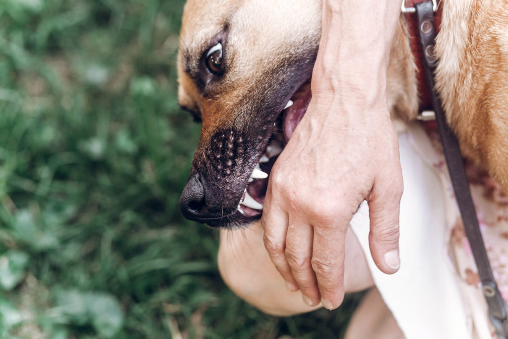 A dog bites a person on the hand.