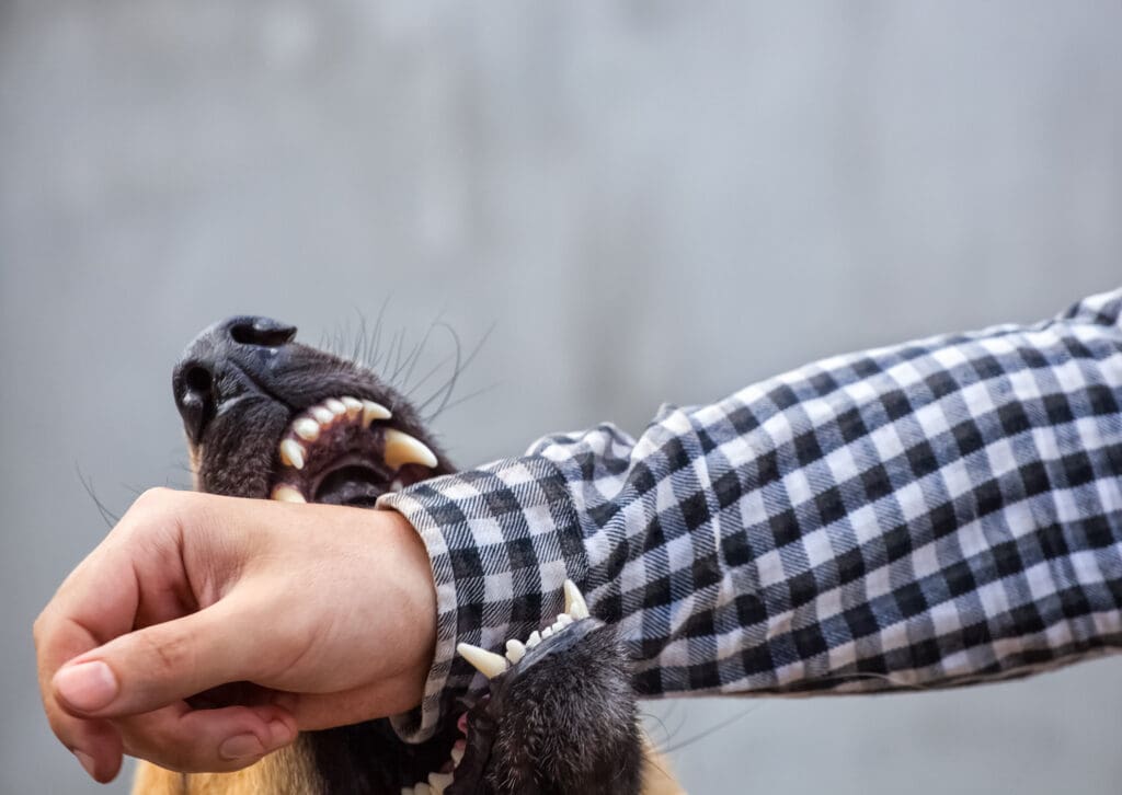 A dog biting a man's arm | Dog Bite Injury